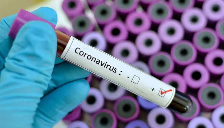 why corona virus got name corona,coronavirus treatment,corona virus protection,coronavirus infection,coronavirus china,Health ,कोरोना वायरस