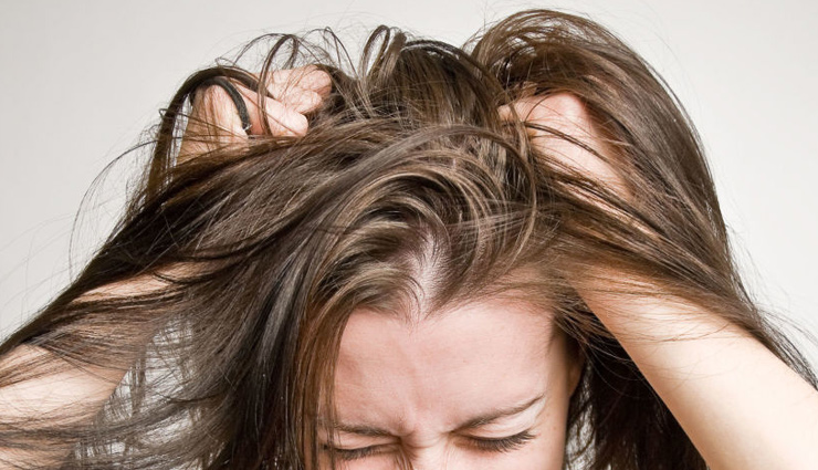 itchy scalp,tips to get rid of itchy scalp,monsoon hair care tips,monsoon tips,hair care tips,beauty tips,hair care