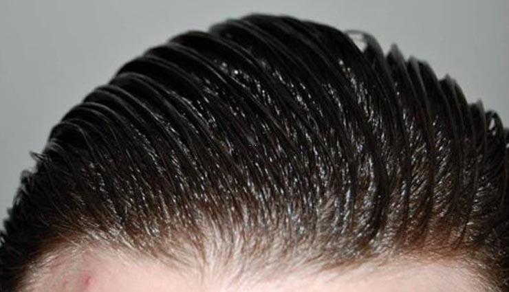tips for remove dandruff from oily hair,beauty tips for oily hair,beauty tips in hindi,beauty tips for girls,dandruff problme