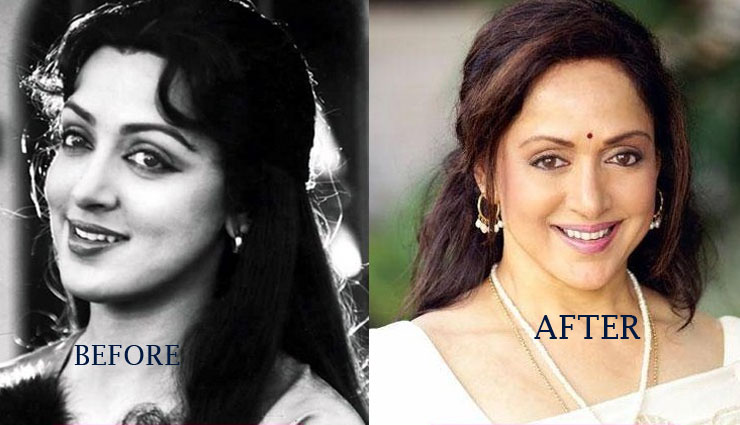 Kareena Kapoor Khan,Shilpa Shetty,Hema Malini,karishma kapoor,aishwarya rai,ayesha takia,bollywood celebrities who went through surgeries,actors who had surgeries for beautiful look,surgeries of bollywood celebrities