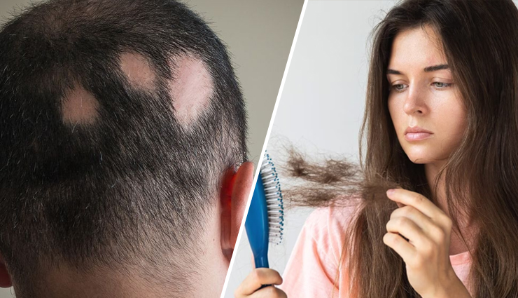 8 Ways To Reduce Hair Fall at Home