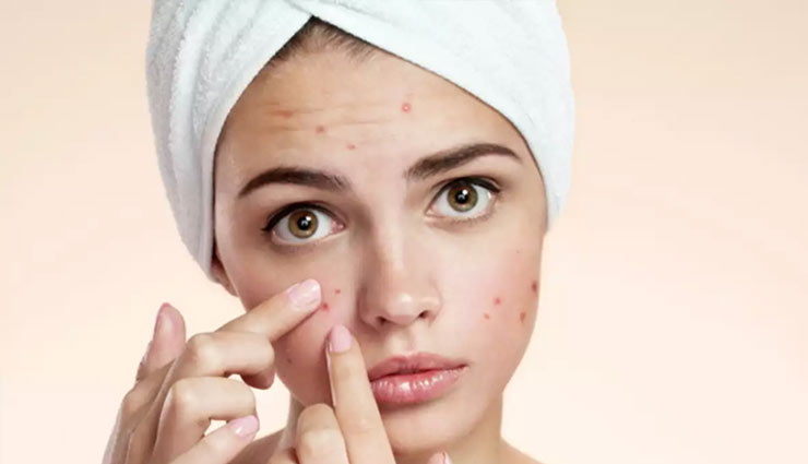 organic rose water,gulab jal,skin,rose water skin,beauty product,rose water chemical,skin toner,make up remover,dark circle,beauty article in hindi