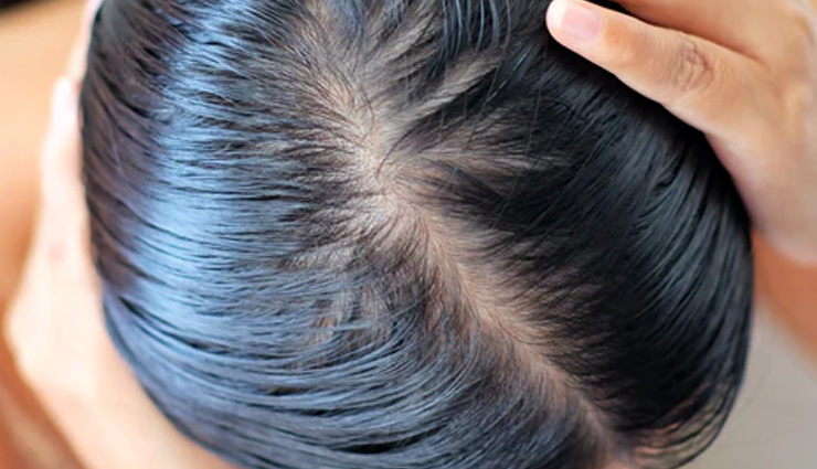 avocado benefits for skin,avocado benefits for hair,avocado skin care,avocado hair care,avocado face mask,avocado hair mask,avocado anti-aging benefits,avocado moisturizing properties,avocado diy skin treatments,avocado hair treatment