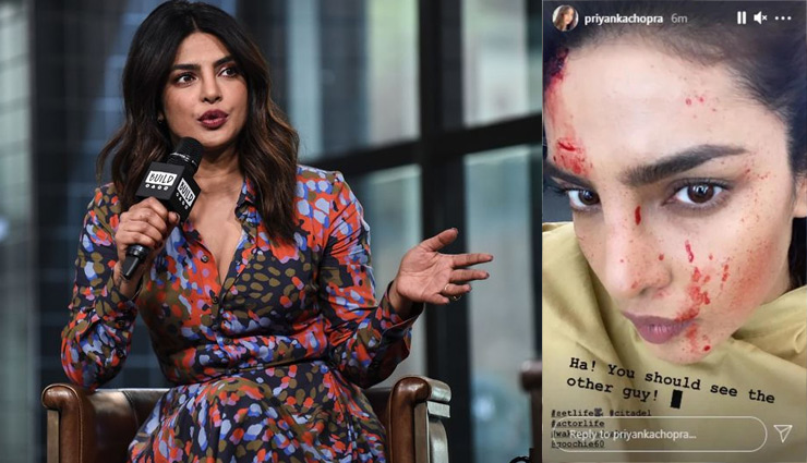 प्रियंका की ऐसी फोटो देख घबराए फैंस! सिर और चेहरे पर नजर आ रहे हैं खून के छींटे, ये है असलियत
