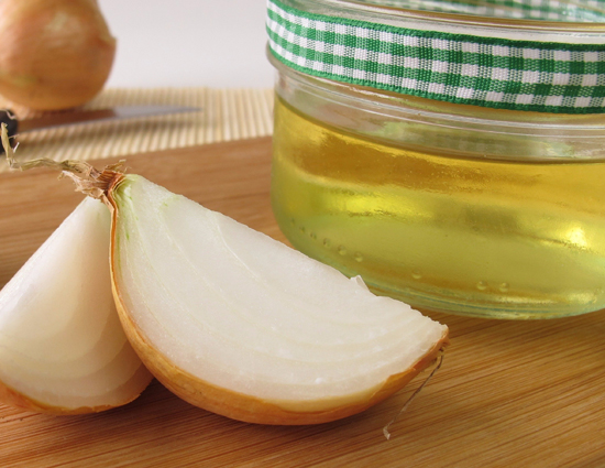 beauty,hair treatment,hairfall,hairfall problem,controll hair fall,Amla in hairfall,onion juice in hairfall,coconut oil in hairfall,aloe vera in hairfall,beet root juice in hairfall,home remedies in hairfall