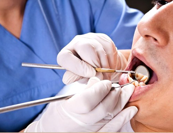 Health,Health tips,healthy living,yellow teeth,yellow teeth caused by smoking,tips to rid of yellow teeth,whitening kit,Yellowing of teeth