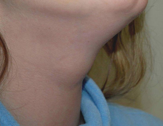 Health tips,garlic,other 5 benefits of garlic,benefits of garlic,uses of garlic