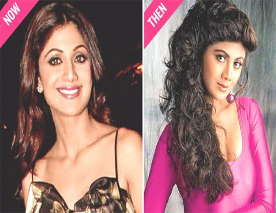 Shilpa Shetty,priyanka chopra,kangana ranaut,actresses after undergoing through surgery,katreena kaif