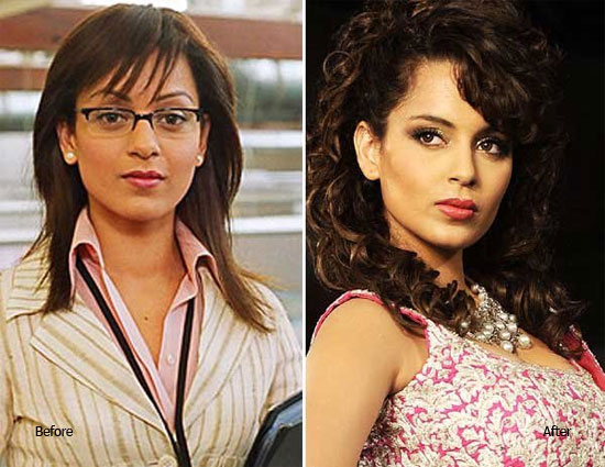 Shilpa Shetty,priyanka chopra,kangana ranaut,actresses after undergoing through surgery,katreena kaif