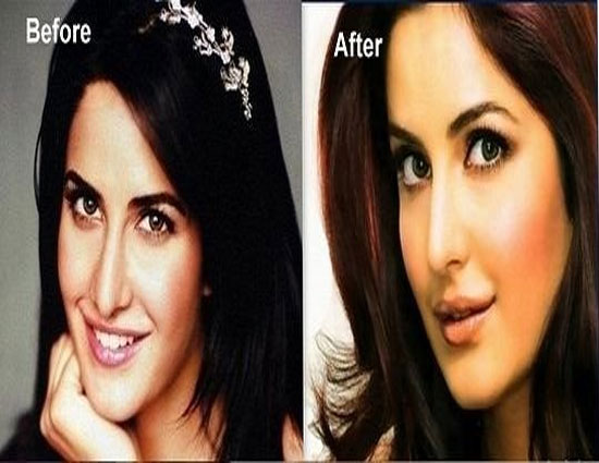 Shilpa Shetty,priyanka chopra,kangana ranaut,actresses after undergoing through surgery,katreena kaif