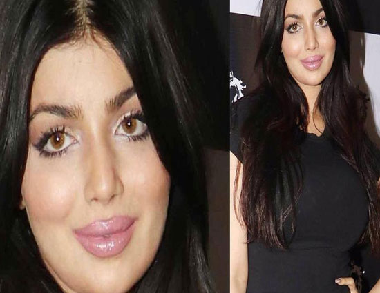 bollywood,entertainment,ayesha takia back in news after years,ayesha takia,ayesha takia surgery