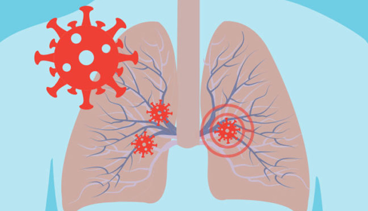 coronavirus,corona period,corona,covid-19,oxygen in body,oxygen,coronavirus,oxygen level,health news in hindi