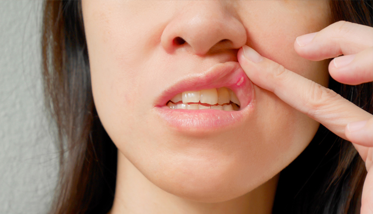 aloe vera,aloe vera juice,skin,digestion,mouth ulcer,acne,hair,skin,weight,swelling,health news in hindi