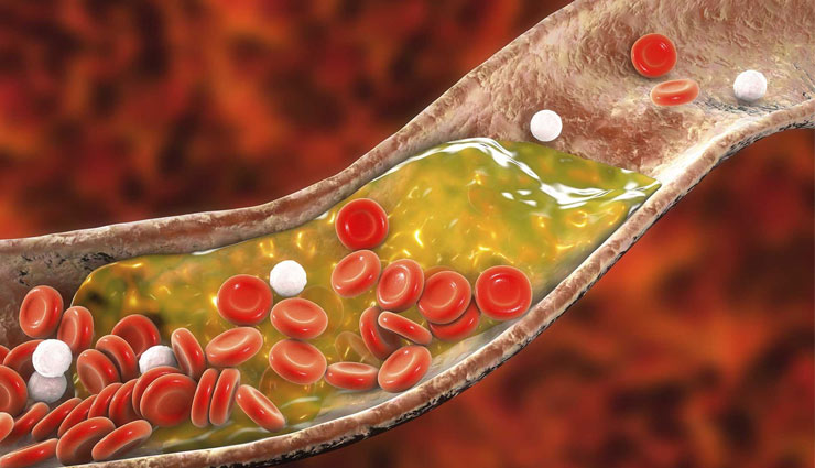 avocado,avocado fruit,avocado medicine,avocado advantages,butter fruit,energy,bad breath,kidney,cholesterol,health article in hindi