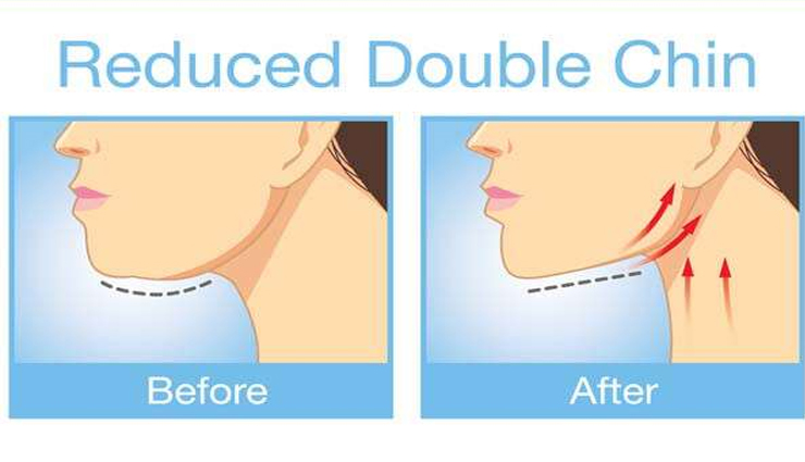 double chin,double chin problem,chin,neck,tongue,tennis ball,chewing gum,health article in hindi