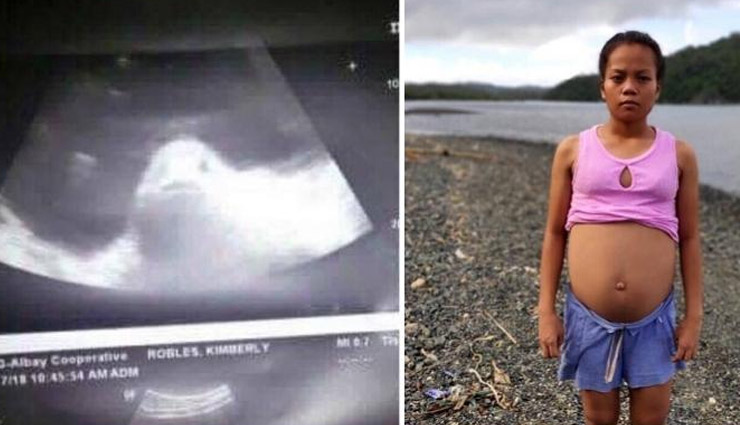 मछली से प्रेगनेंट हुई ये लड़की, अल्ट्रासाउंड रिपोर्ट में सामने आई चौकाने वाली तस्वीर!
