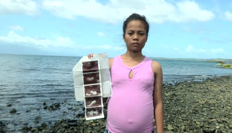 fish,girl pregnant with fish,ultrasound report,weird news