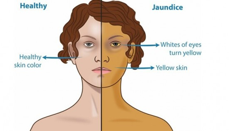 water chestnut,singhara,water chestnut benefits,water chestnut medicinal value,health news in hindi