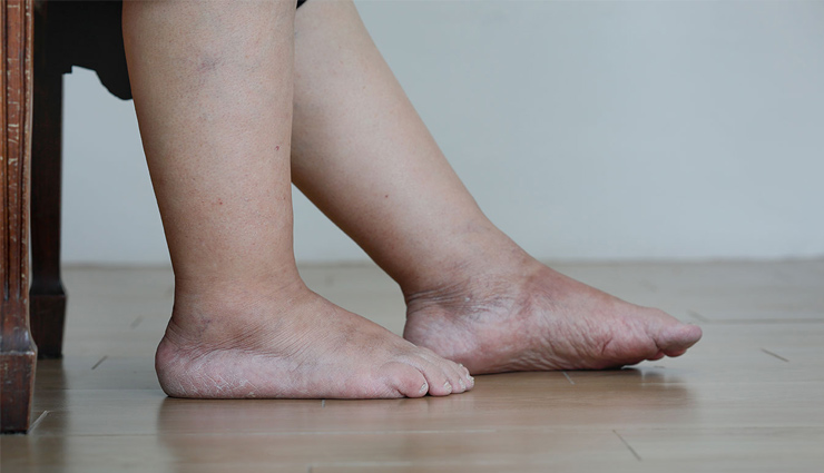 healthy foods,superfoods,whey proteins,water,water retention,diet,fats,restaurant,fruit juice,carbs,sprouts,hot water,health article in hindi