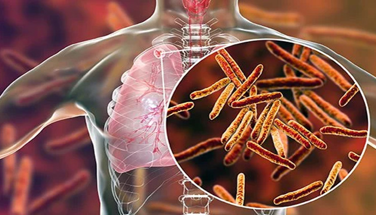 honey,hive,honey bee,ayurvedic medicine,digestion,fever,tuberculosis,health news in hindi