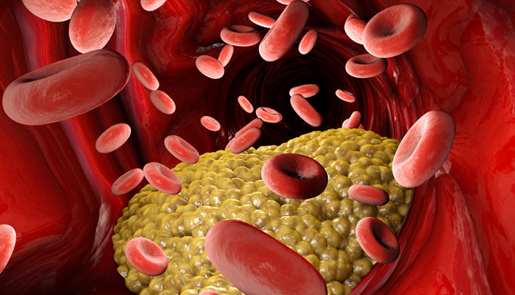 ghee,ghee advantages,ghee medicinal value,heart,cholesterol,cancer,eyesight,bone,health article in hindi