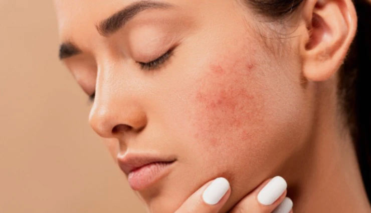 sunflower,sunflower oil,sunflower benefits,sunflower oil advantages,sunflower oil diseases,skin,hair,wound,anti aging,health article in hindi