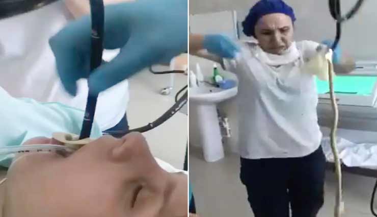 मुंह के जरिए महिला के पेट से निकाला चार फीट लंबा सांप, आग की तरह वायरल हो रहा विडियो