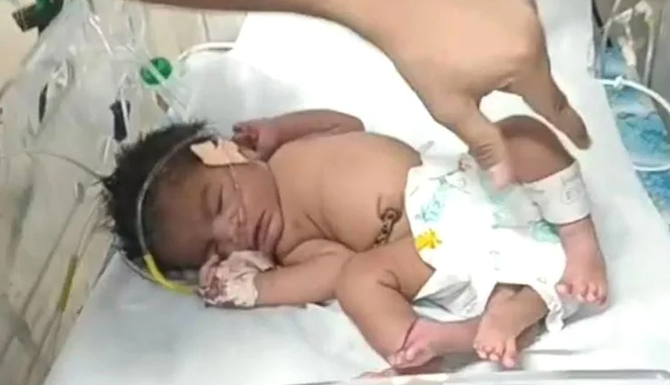 महिला ने दिया 4 पैरों वाली बच्ची को जन्म,  लोग बोले - दैवीय अवतार