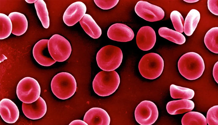 curry tree,curry tree advantages,curry tree medicinal values,eyesight,anemia,diarrhea,diabetes,weight,grey hair,health article in hindi