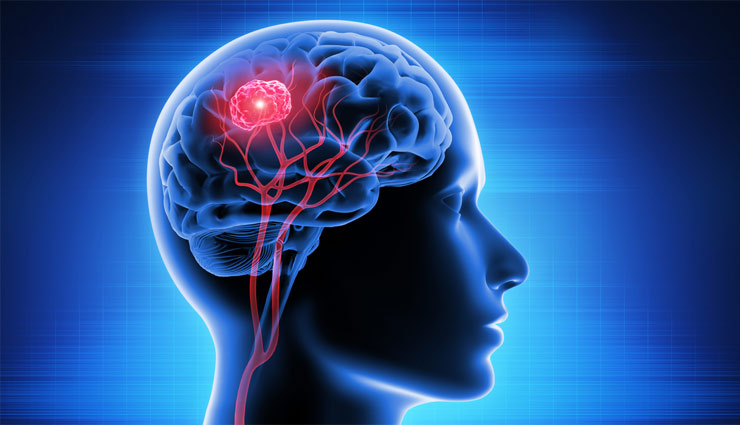 noni fruit,noni,noni fruit juice,diabetes,pregnancy,cancer,immunity,acidity,anti oxidant,health article in hindi