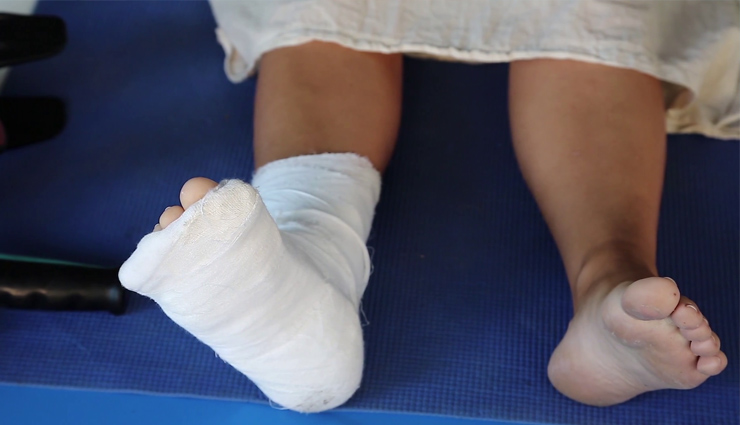 bones,strong bones,osteoporosis,healthy bones,bone loss,calcium,fracture,health article in hindi