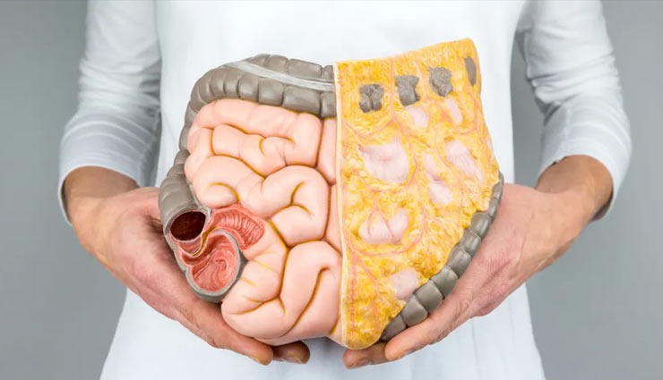 Apple,apple fruit,apple diseases,apple health,respiration,heart,toothache,skin,diabetes,intestine,constipation,overweight,health article in hindi