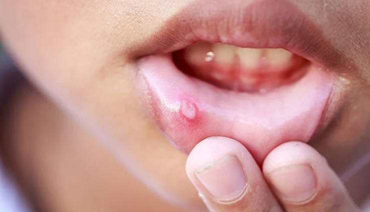 curd,human body,calcium,milk,bones,digestion,skin,hair,protein,rayta,lassi,heajth news in hindi