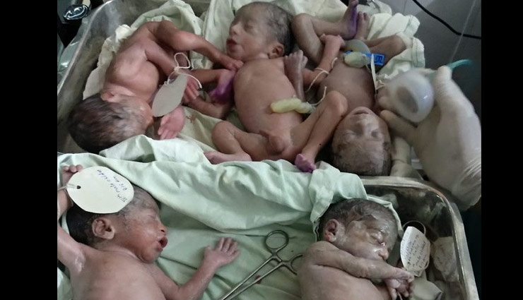 महिला ने एकसाथ दिया 5 बच्चों को जन्म, एक की हुई मृत्यु