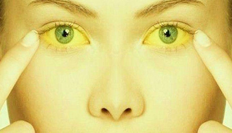 health benefits,giloy,giloy health benefits,diabetes,giloy leaf,liver,eyes,tb,health news in hindi