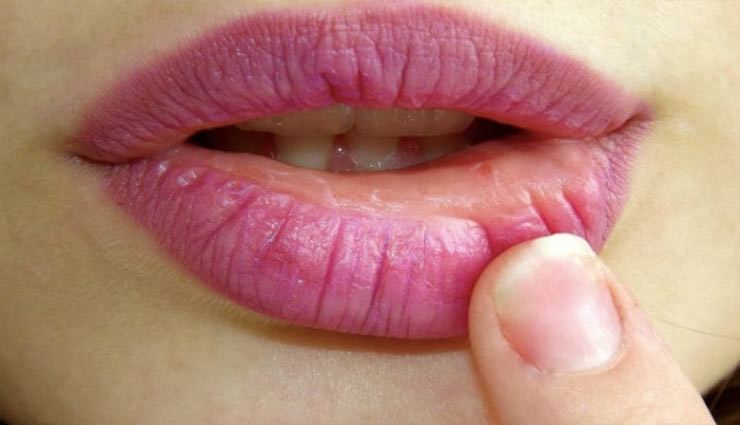 asafoetida,hing,hing medicinal benefits,digestion,whooping cough,headache,coldness,cough,diabetes,swelling on lips,health article in hindi