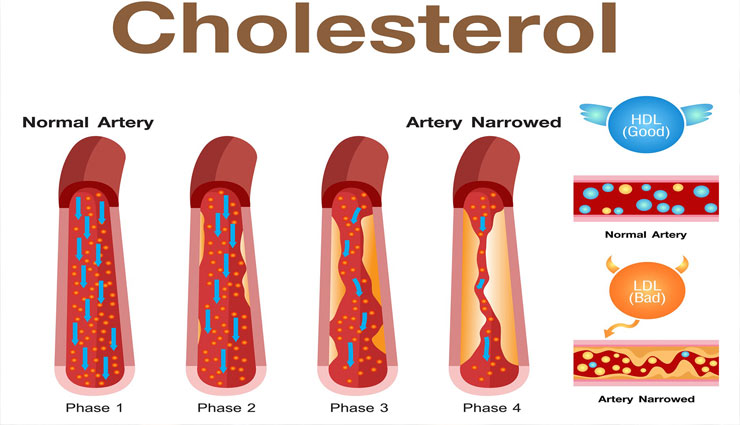 yellow moong dal,chana dal,masoor dal,kali beans,dal,pulses,pulses benefits,pulses medicine,health article in hindi