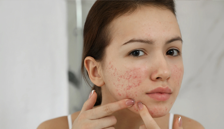 java plum,jamun,java plum medicine,java plum juice,digestion,eyes,skin,jaundice,liver,diabetes,health news in hindi