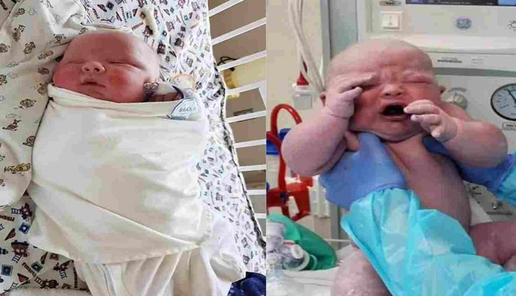 महिला ने दिया साढ़े 6 किलो वजन के बच्चे को जन्म, मंगवाना पड़ा स्पेशल आर्डर देकर डायपर