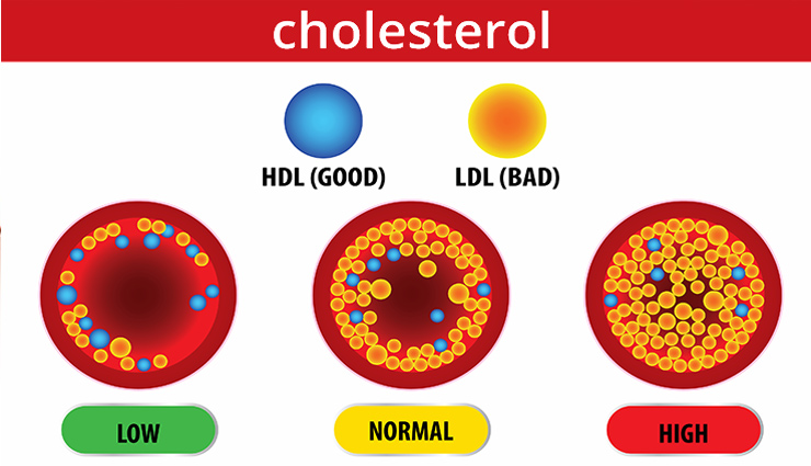general diseases,diseases,men diseases,prostate cancer,kidney,liver,cholesterol,heart,health article in hindi