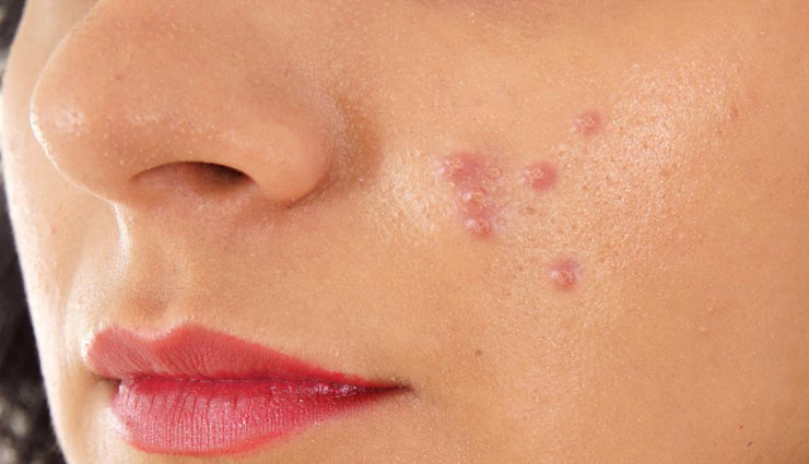 diet,season,diet season,Health,shishir,basant,greesham,varsha,sharad,hemant,winter,summer,rainy season,health article in hindi