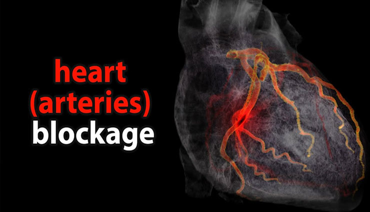 cholesterol,high cholesterol,lipid,plasma,cells,high cholesterol reasons,high cholesterol symptoms,high cholesterol control,health article in hindi