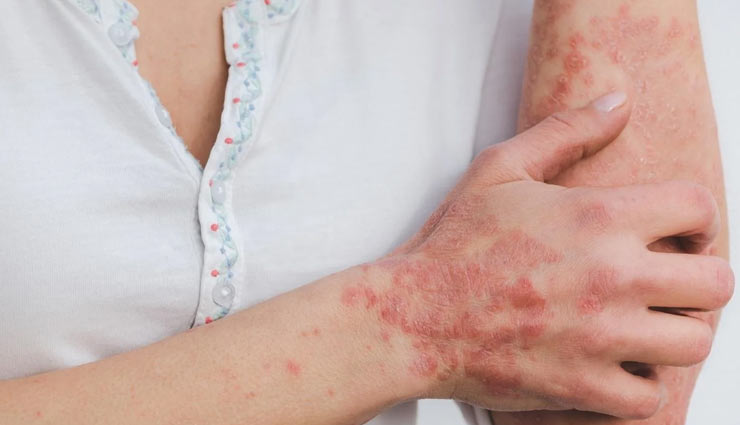 coronavirus,kachi haldi,raw turmeric,turmeric,kachi haldi vegetable,insomnia,infection,immunity,cancer,kachi haldi sabji recipe,health article in hindi