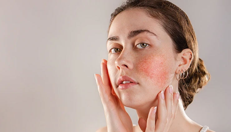 aloe vera gel,aloe vera,aloe vera benefits,aloe vera advantages,acne,sunburn,hair,swelling,health and beauty article in hindi