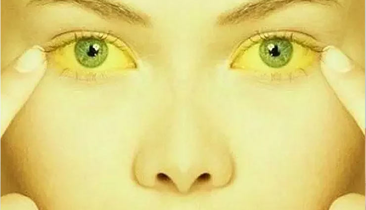 coconut water,coconut,coconut water medicine,coconut water advantages,skin,hair,fever,pregnancy,empty stomach,coconut crush,health article in hindi