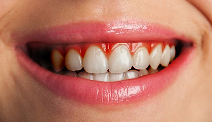 coronavirus,shikanji,nimbu pani,Lemon,shikanji health,health drink shikanji,stomach,dehydration,vomiting,gum,energy,skin,health article in hindi