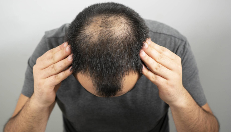 bhringraj oil,bhringraj tail,hair,bhringraj oil hair,bhringraj tail hair,dandruff,baldness,grey hair,health news in hindi,beauty news in hindi