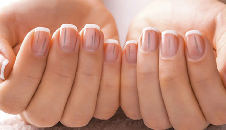 nails,diseases,nails diseases,nails shape,nails colour,jaundice,yellow nails,lines on nails,health article in hindi