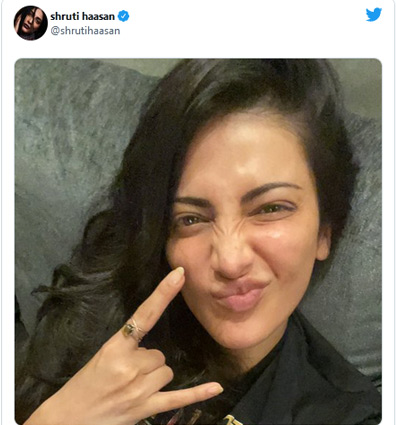 yami gautam,shruti hassan,shehnaaz gill,yami skin problem,shruti photo,sidharth shukla,bollywood news in hindi