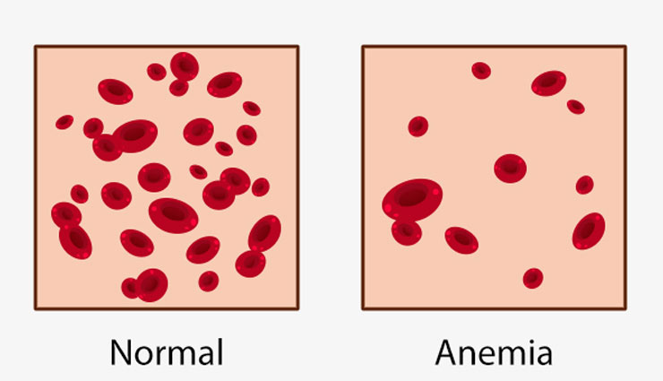 अनार से जुड़े हैं सेहत के तार, हर बीमारी में हमें संभालकर फिर से कर देता है मजबूती से खड़ा! pomegranate,pomegranate remedy,vitamin,pomegranate health,pomegranate doctor,immunity,anemia,thirst,cancer,baldness,health article in hindi